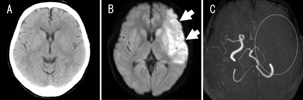 放射線診断科 東北大学病院