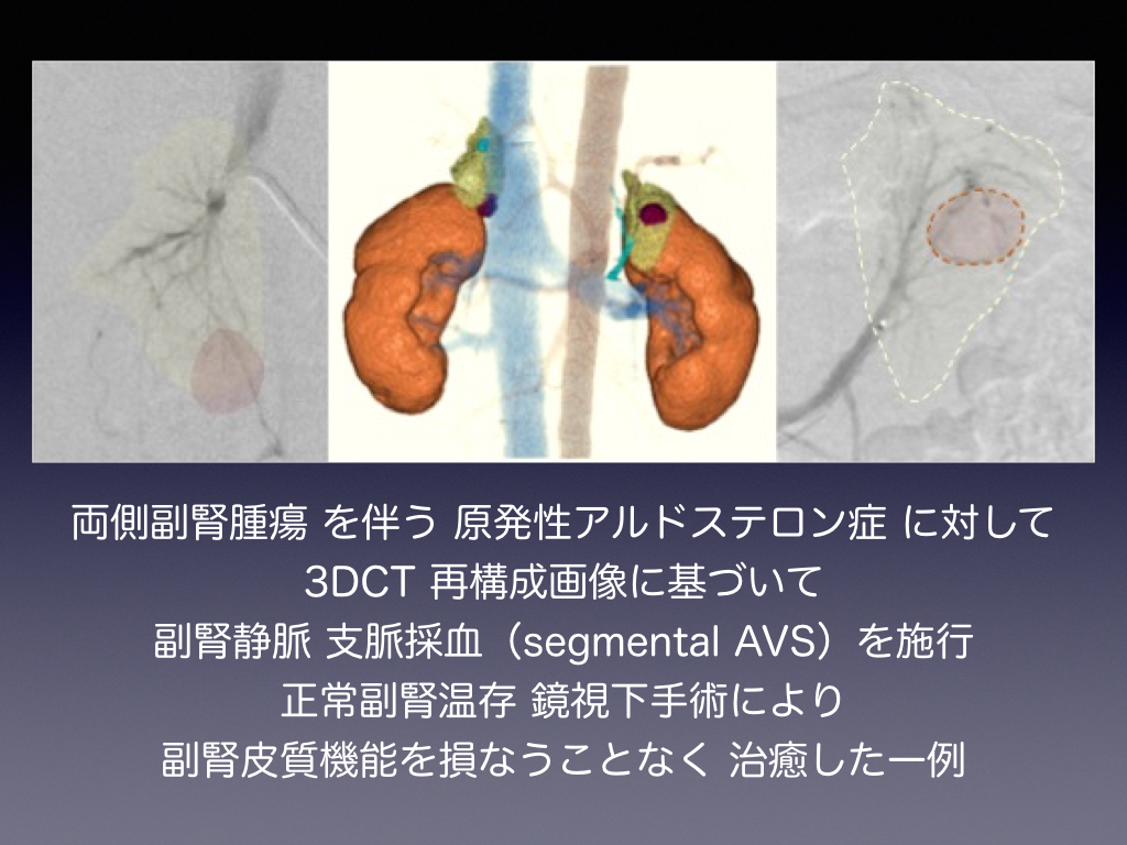 腎 高血圧 内分泌科 東北大学病院