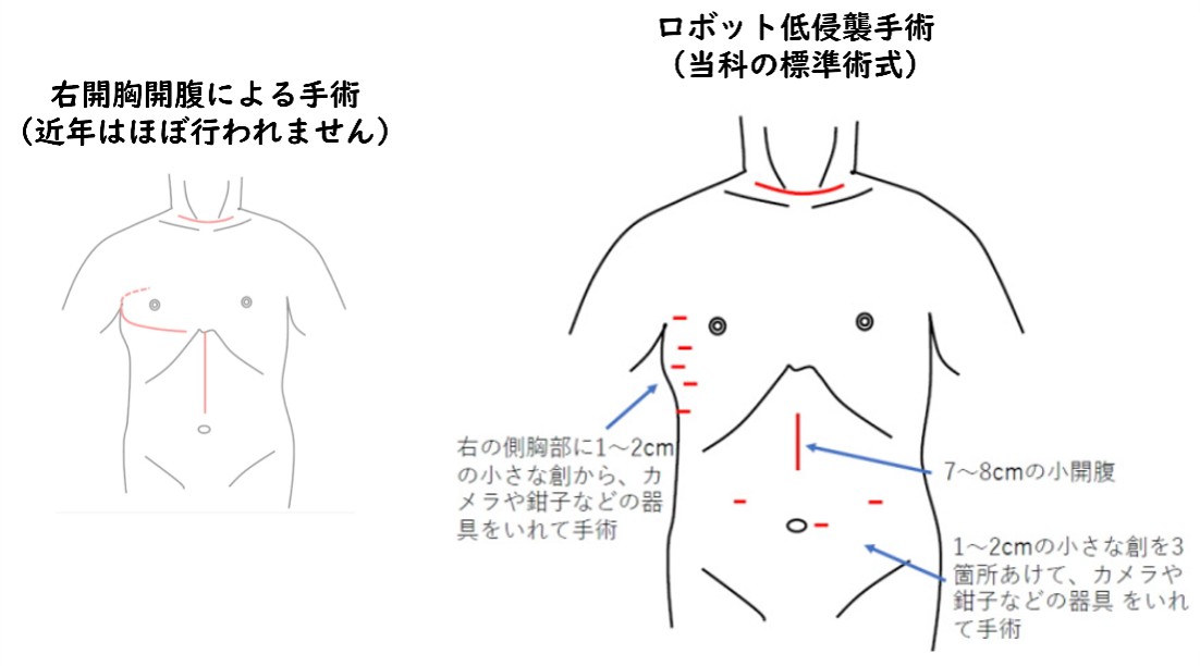 総合外科 上部消化管・血管グループ - 東北大学病院